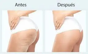 Lanluma: bioestimular el volumen con armonía y tiempo